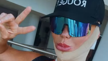 Modelo trans de Costa Rica, Vinna Rouge, se sometió a impactante cirugía estética que duró 14 horas