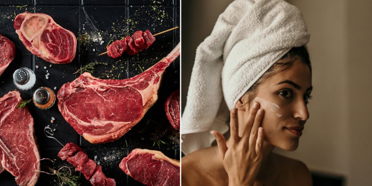 Cuál carne tiene más colágeno. Foto: El Tiempo, Colombia