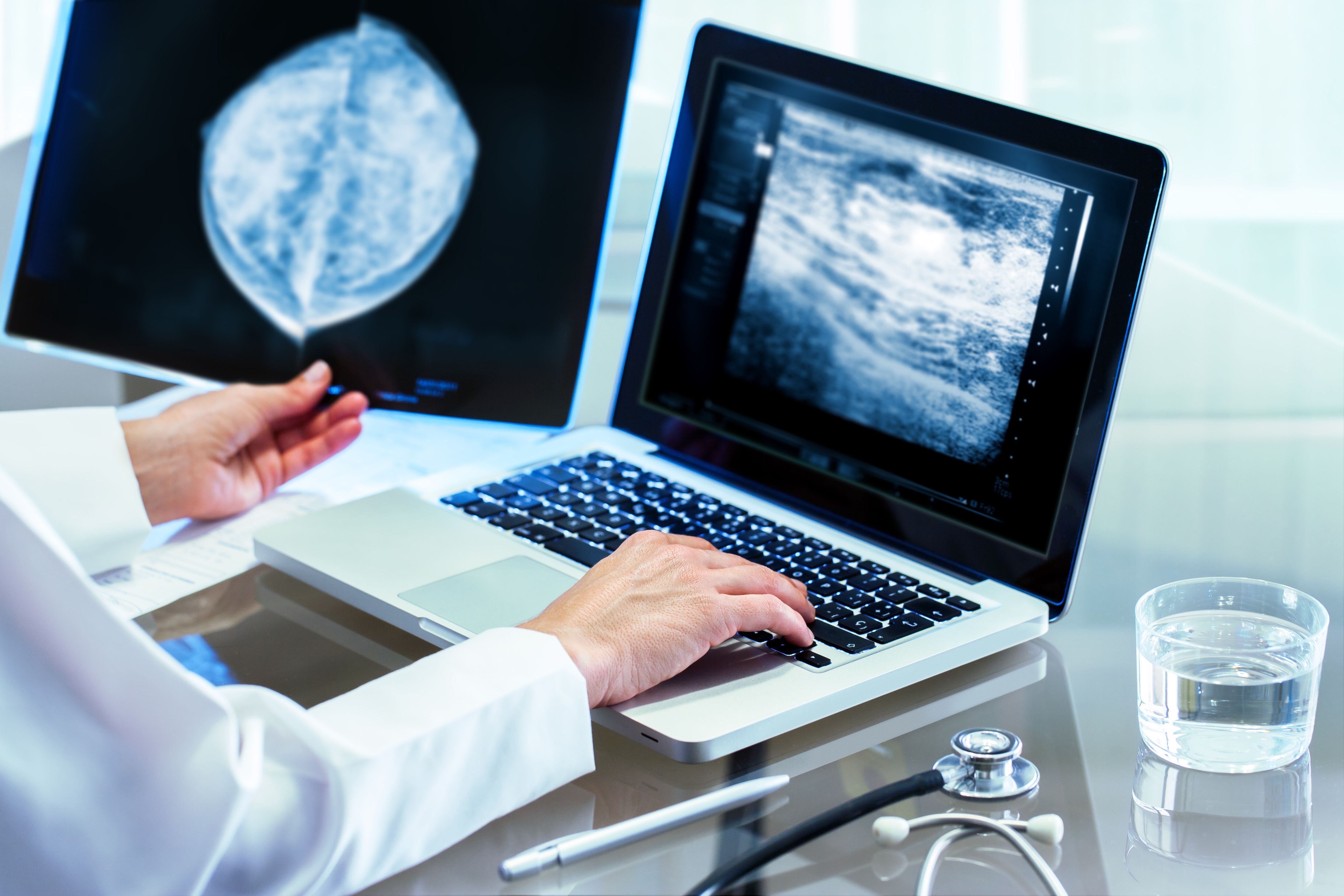Médico revisa una mamografía en pantalla de computadora y sostiene una radiografía como parte del tamizaje para el diagnóstico de cáncer de mama.
