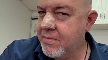 Domingo Argüello ya salió del hospital y no va a creer quién lo operó