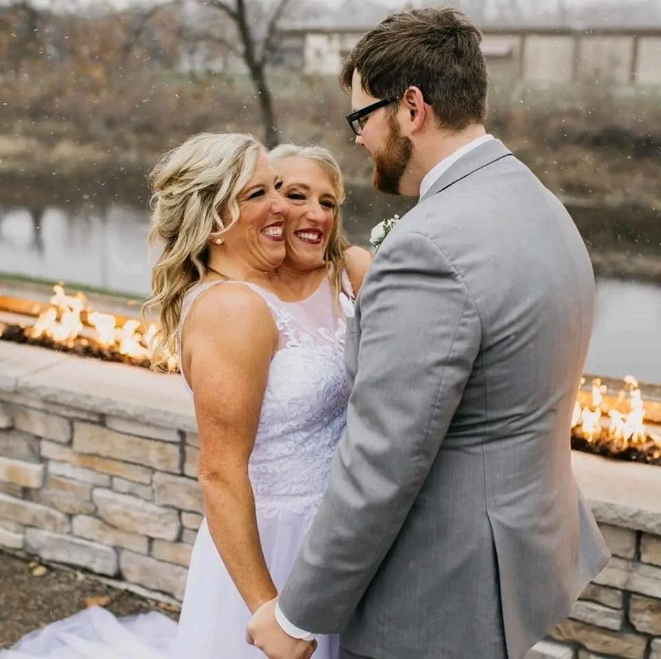 Una de las gemelas siamesas más famosas del mundo, Abby Hensel, ya está felizmente casada, mientras su hermana, Brittany, con quien comparte el mismo cuerpo, esta solterita y sin compromiso.