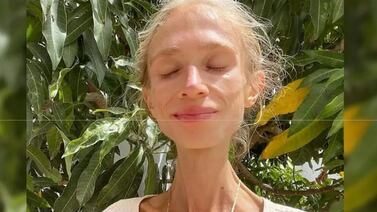 Muere Karolina Krzyżak influencer que solo comía frutas: pesaba menos de 50 libras