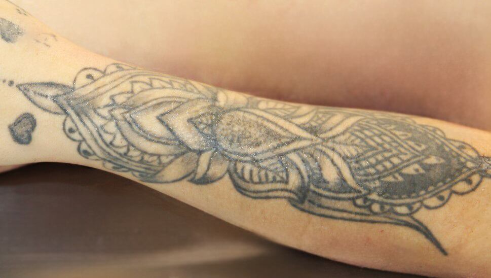 Tatuajes serían claves para identificar a mujer que falleció tras ser atropellada en Ipís.