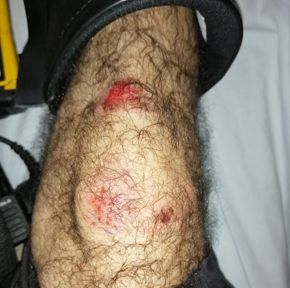 Oficial de Tránsito es atropellado por conductor en Guatuso. Foto Edgar Chinchilla.