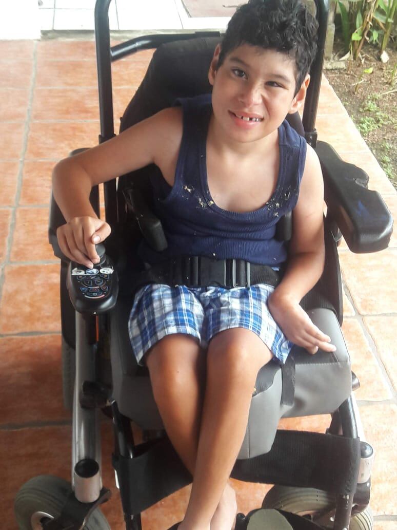 Jeanca ocupa de su ayuda para poderse operar en Colombia