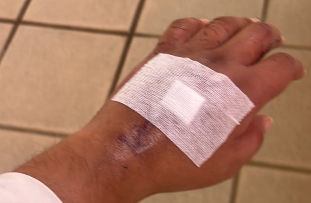 Jason Ureña, periodista de Telenoticias sigue en recuperación tras su accidente de tránsito.