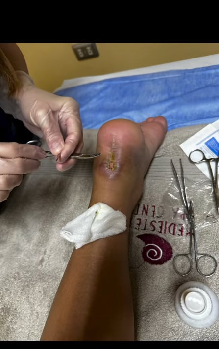 Esposa de Ricardo Blanco mostró el proceso de recuperación del jugador.