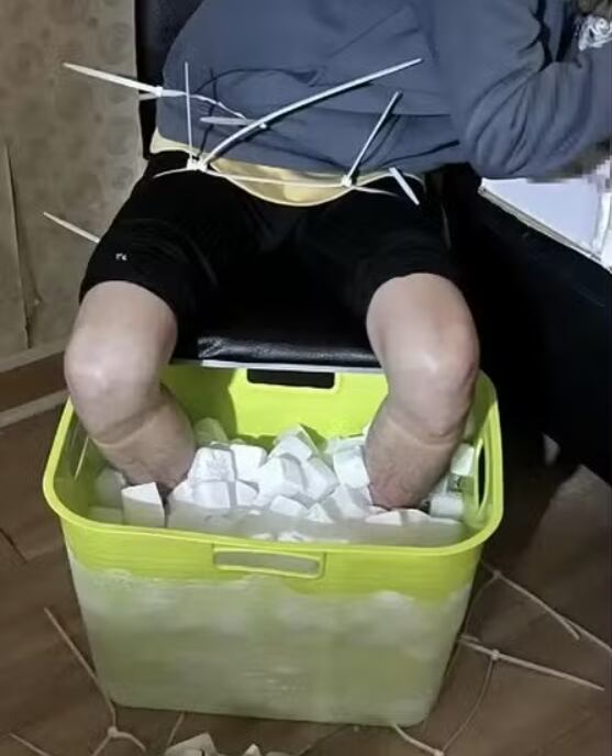 Hombre se provocó la amputación de sus piernas