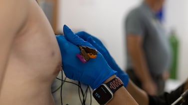 ¿Siente a veces que el corazón le palpita rápido? Médico explica las señales de cuándo hay que correr al hospital