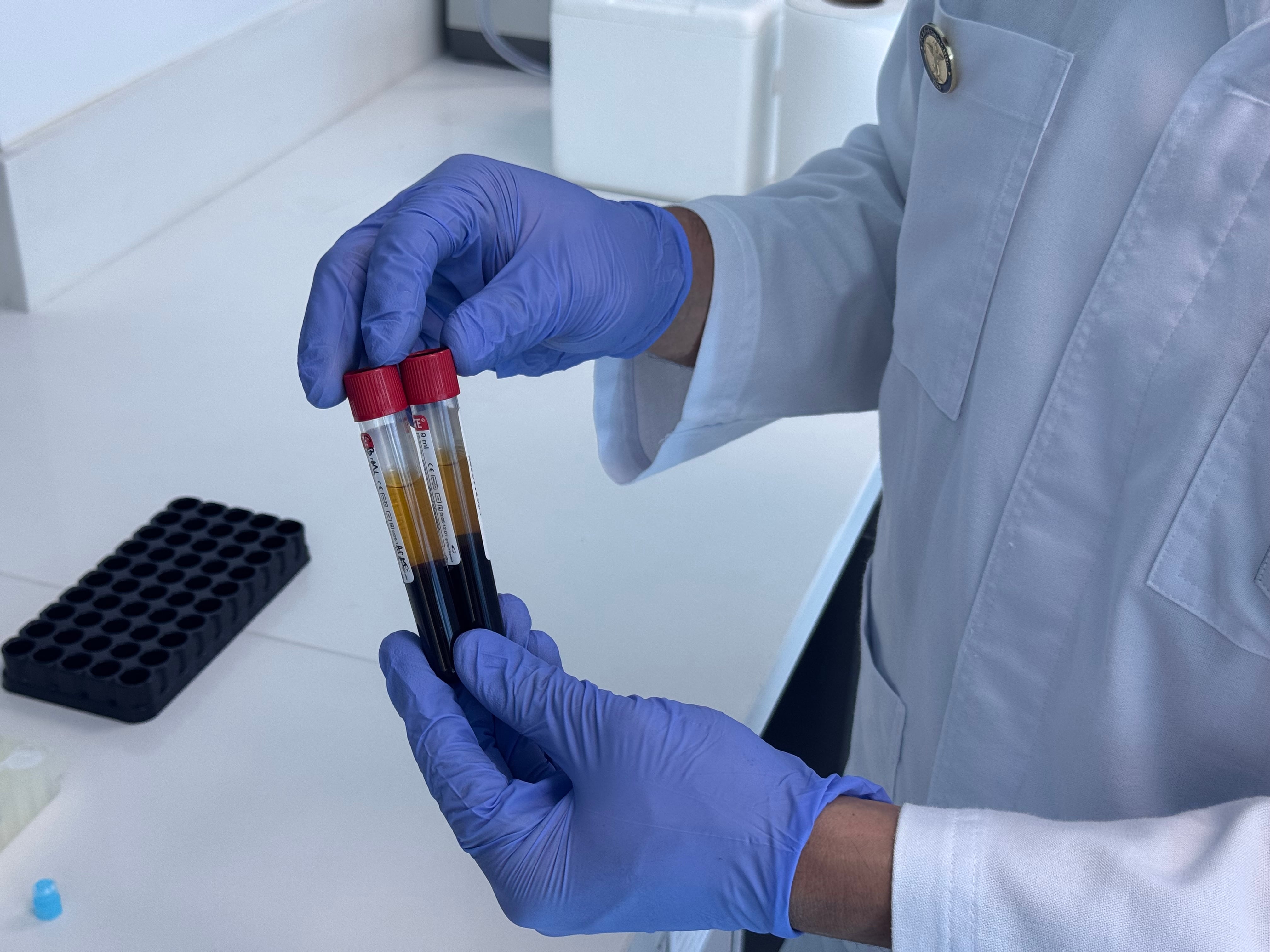 ऑन्कोलॉजिक तंत्रज्ञान संभाव्य कर्करोग शोधते