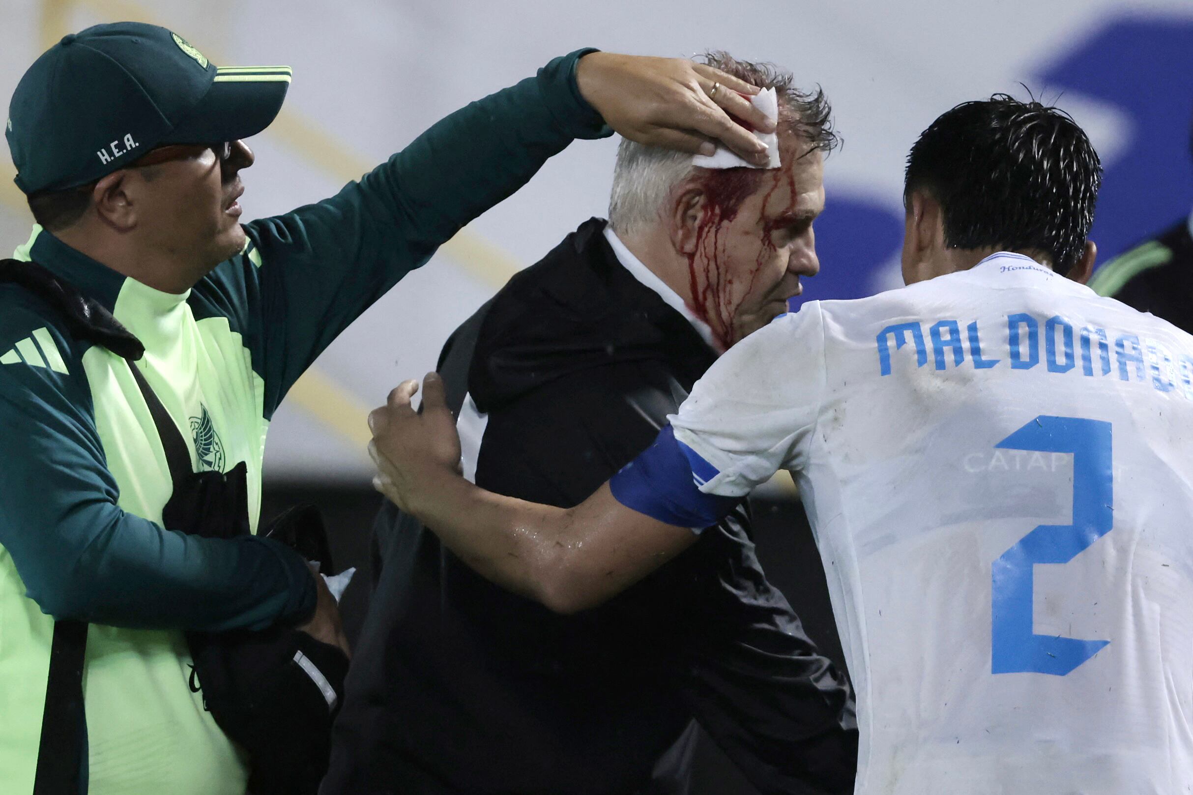 El hondureño Denil Maldonado llegó a ayudar a Javier Aguirre tras el botellazo, durante el partido entre Honduras y México.