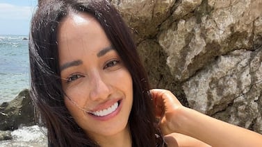 Expareja de Alonso Solís sufrió un accidente que la tiene inmovilizada