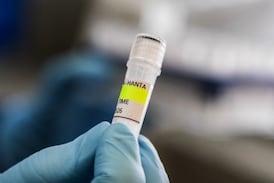 ¿Qué es el hantavirus y cuáles son los síntomas de la enfermedad que preocupa al mundo?