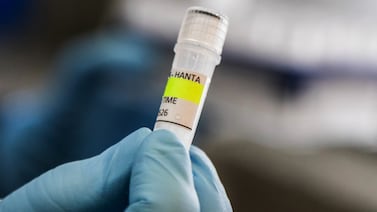 ¿Qué es el hantavirus y cuáles son los síntomas de la enfermedad que preocupa al mundo?