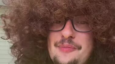 Famoso aficionado del Manchester United del reto del pelo sufrió una dura noticia
