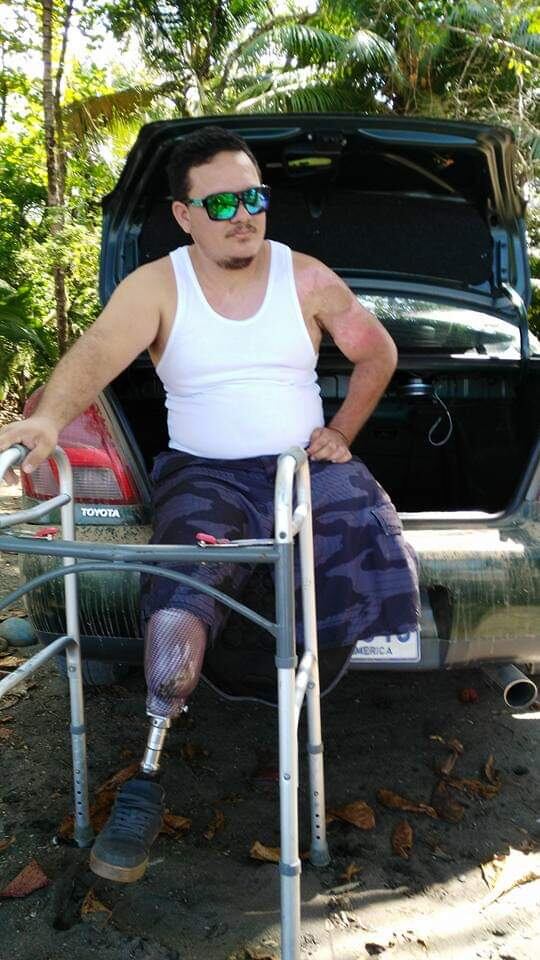 A las 6:05 de la mañana del 19 de octubre del 2011 la vida de Alexánder Palma Solano, quien ahora tiene 40 años, cambió para siempre porque le pasaron por el cuerpo 20 mil voltios mientras trataba de instalarle Internet a una familia de Piedras Blancas de Osa, en la Zona Sur.