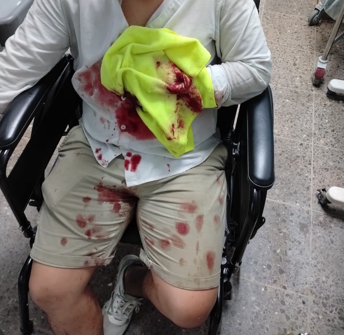 Jason Ureña, periodista de Telenoticias, tras su accidente en Limón.