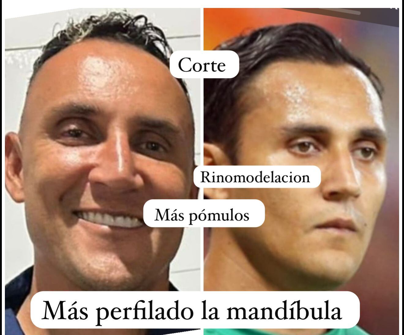 Keylor Navas, portero de la Selección Nacional y el doctor Eric Rojas.