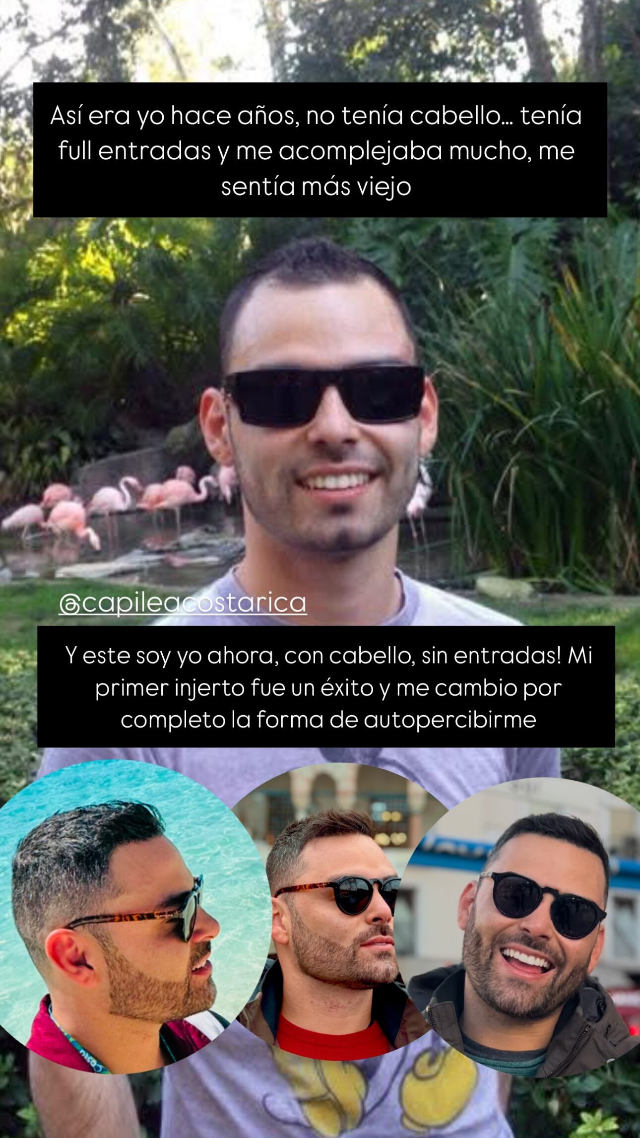 Diego Bravo se sometió este miércoles a un nuevo tratamiento estético que atacará de una vez por todas un complejo que ha tenido toda su vida.