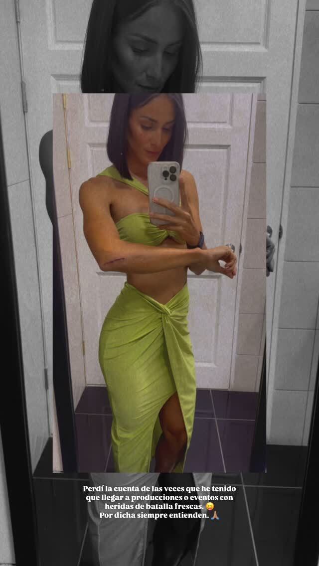 Johanna Solano expuso este miércoles una situación que le viene pasando de un tiempo para acá y por la que ha tenido que dar explicaciones más de una vez en algunos trabajos que la contratan.