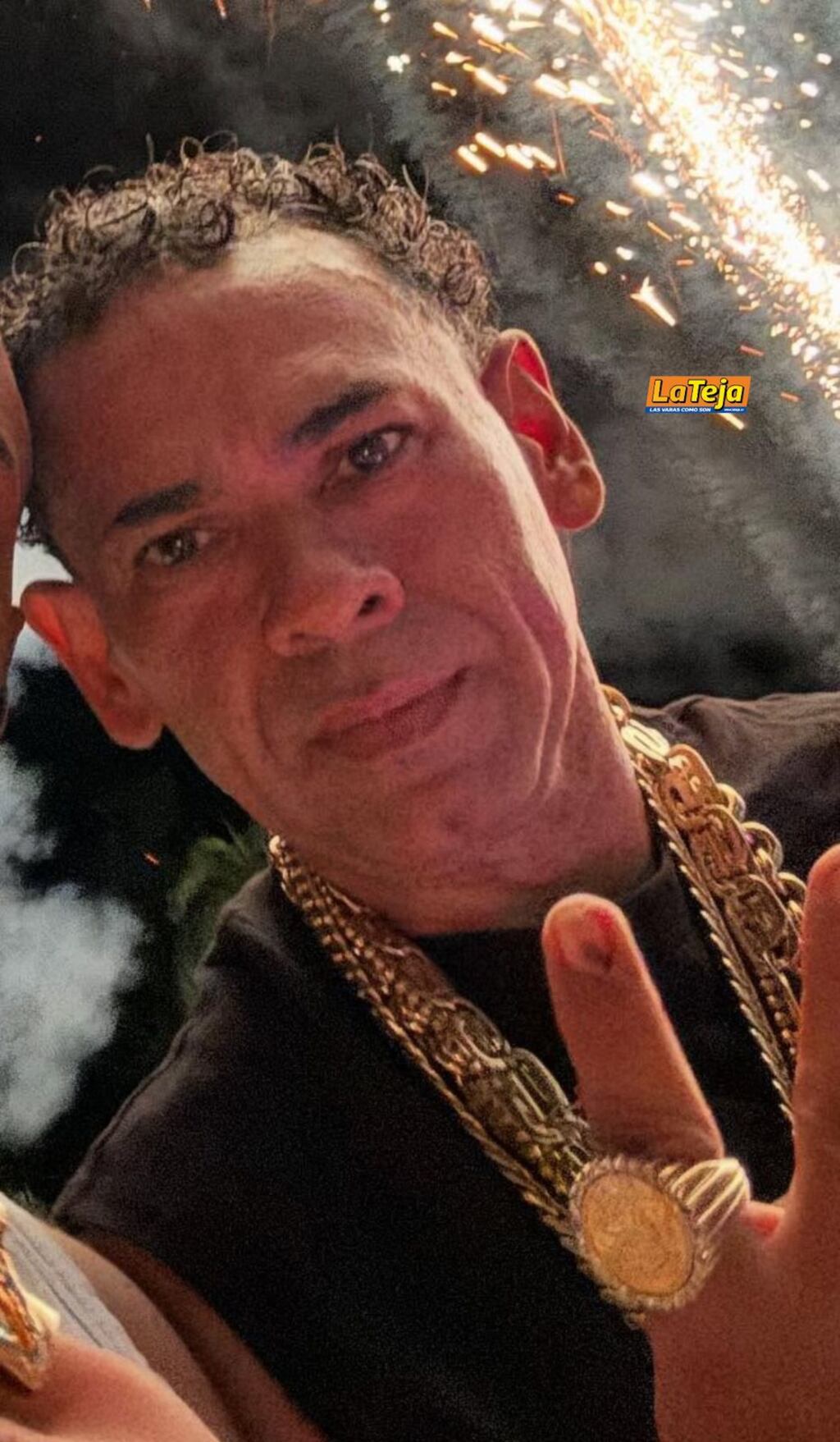 Pecho de Rata dice sufrir intensos dolores por una reciente operación ...