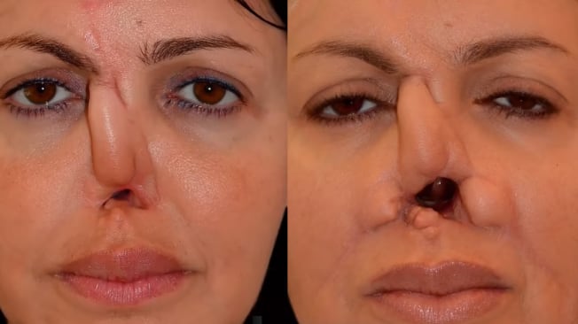 Exmodelo Alisa Kazmina. Fotos: El Tiempo, GDA