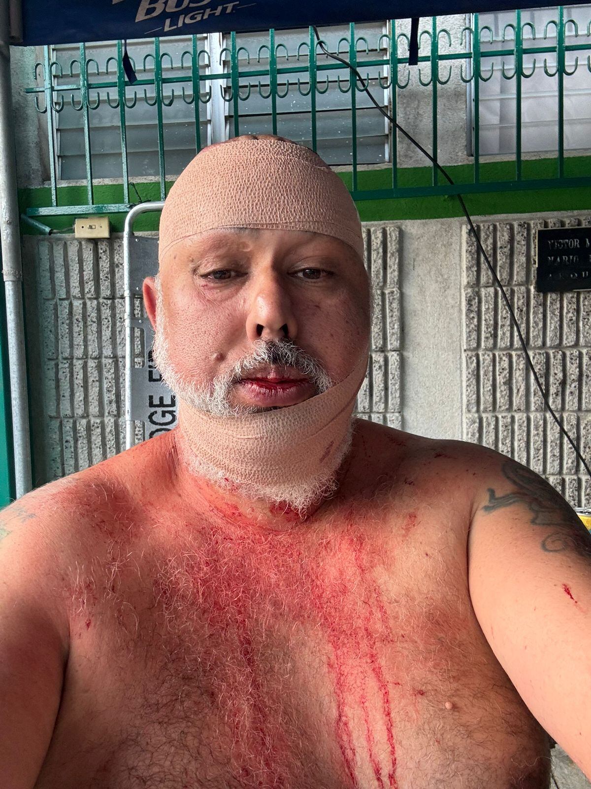 Aficionado de Alajuelense agredido en Guatemala, Christian Castro