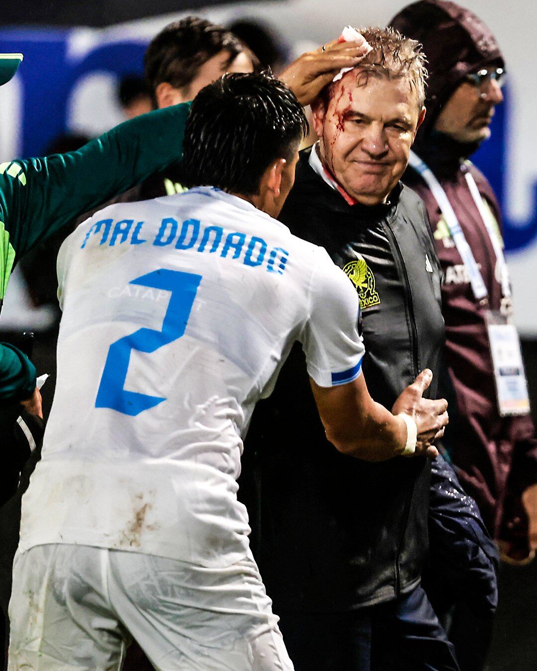 Javier Aguirre salió con un corte muy fuerte en su cabeza en el partido entre Honduras y México. Foto: X