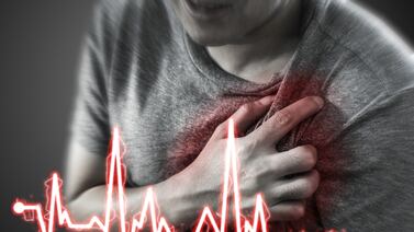 ¿Cuál es el día en que los costarricenses sufren más infartos? Descúbralo aquí