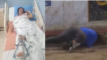 Torera improvisada que sufrió lesión en Zapote debe enfrentar otra cirugía