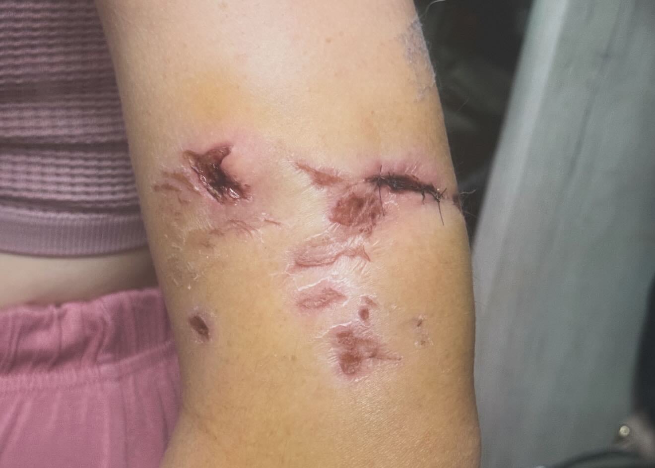 Andreína Méndez, bailarina costarricense.