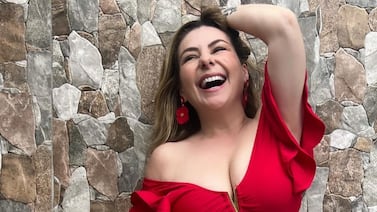 Glenda Peraza se hizo arreglito estético hace meses y ya se ven los sorprendentes resultados