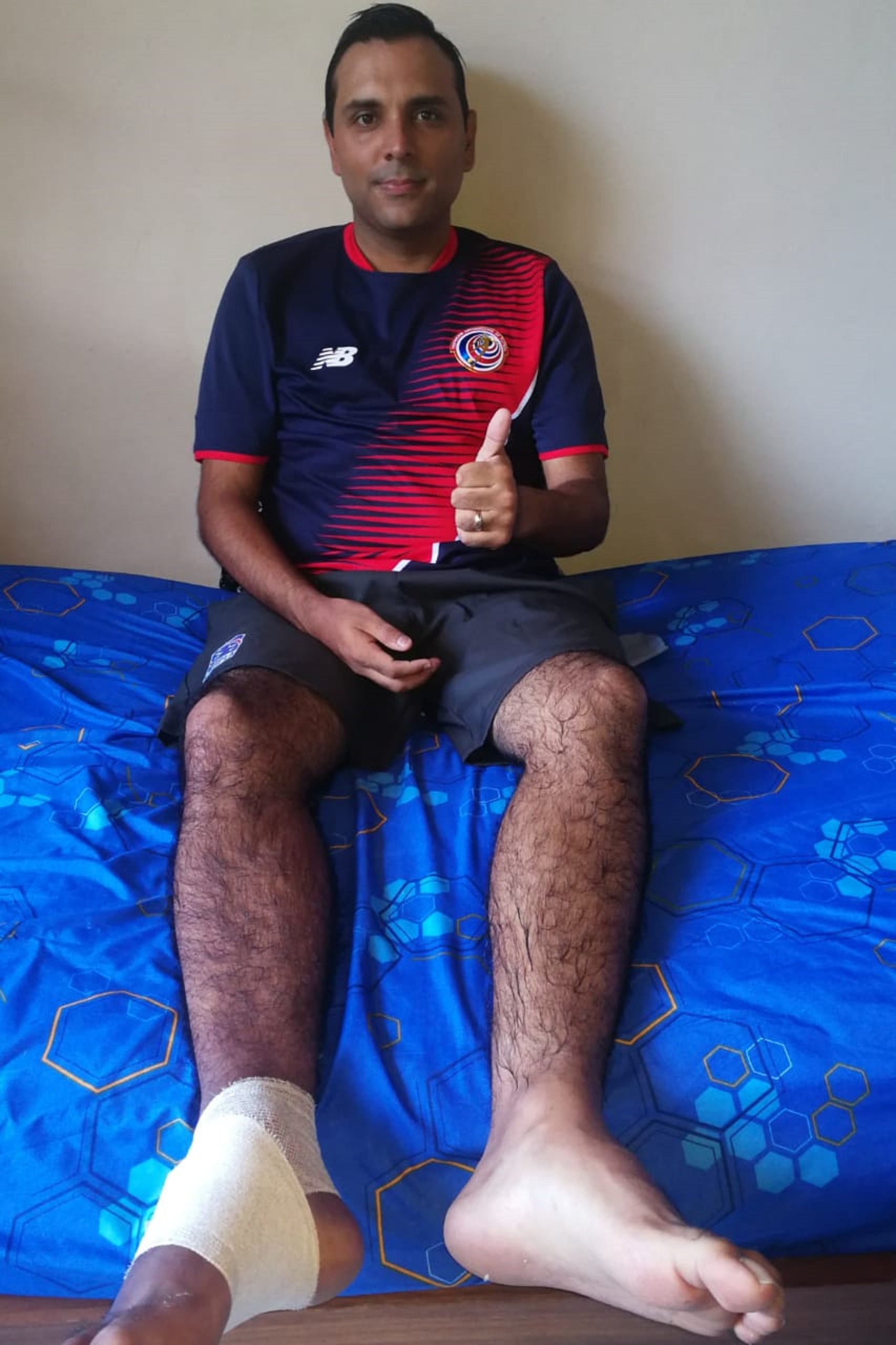 Alexánder Loría: “Por un simple raspón me entró una bacteria y casi me tienen que amputar un pie”