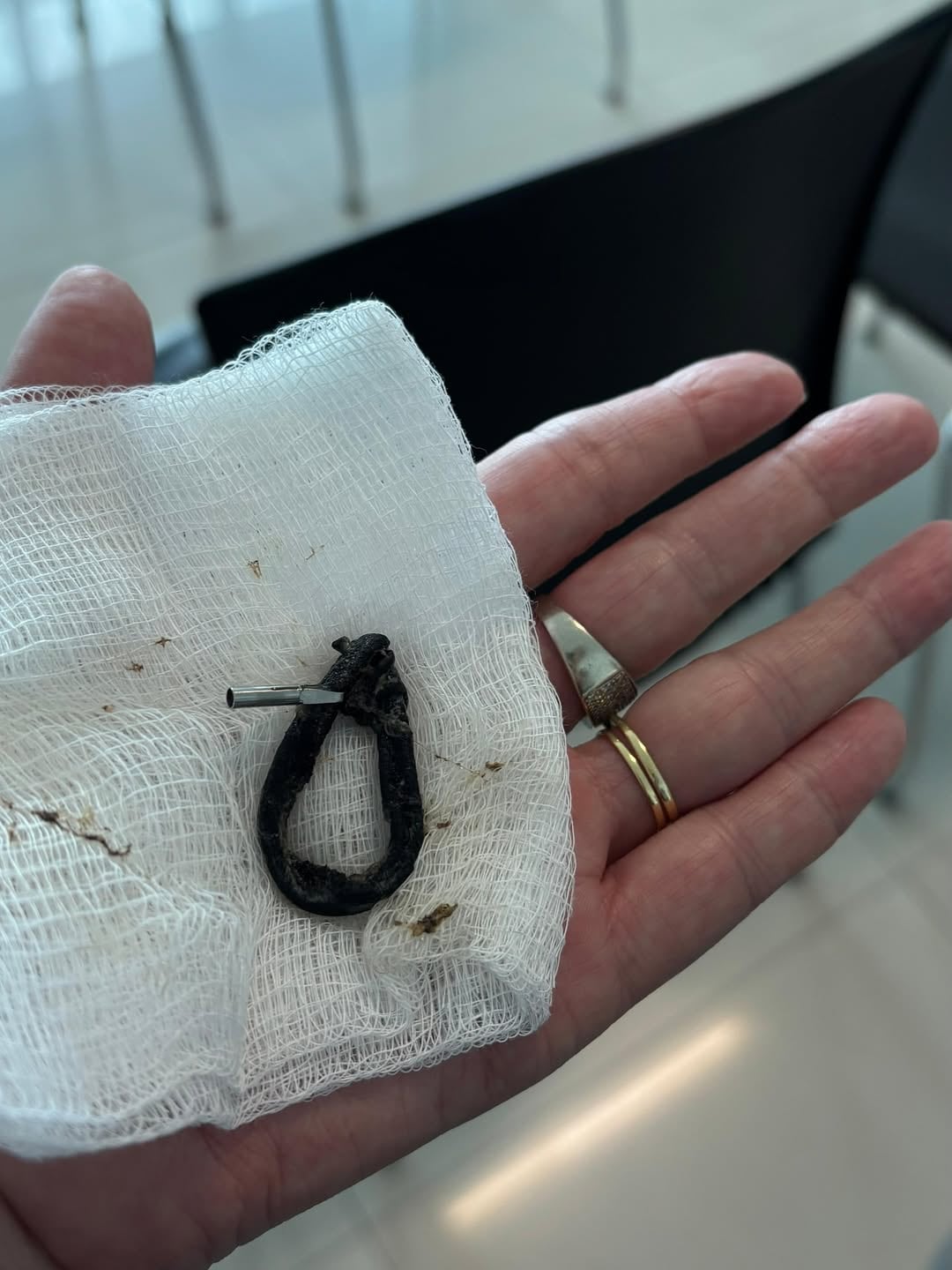 Federico "Kiko" Robles ya fue operado