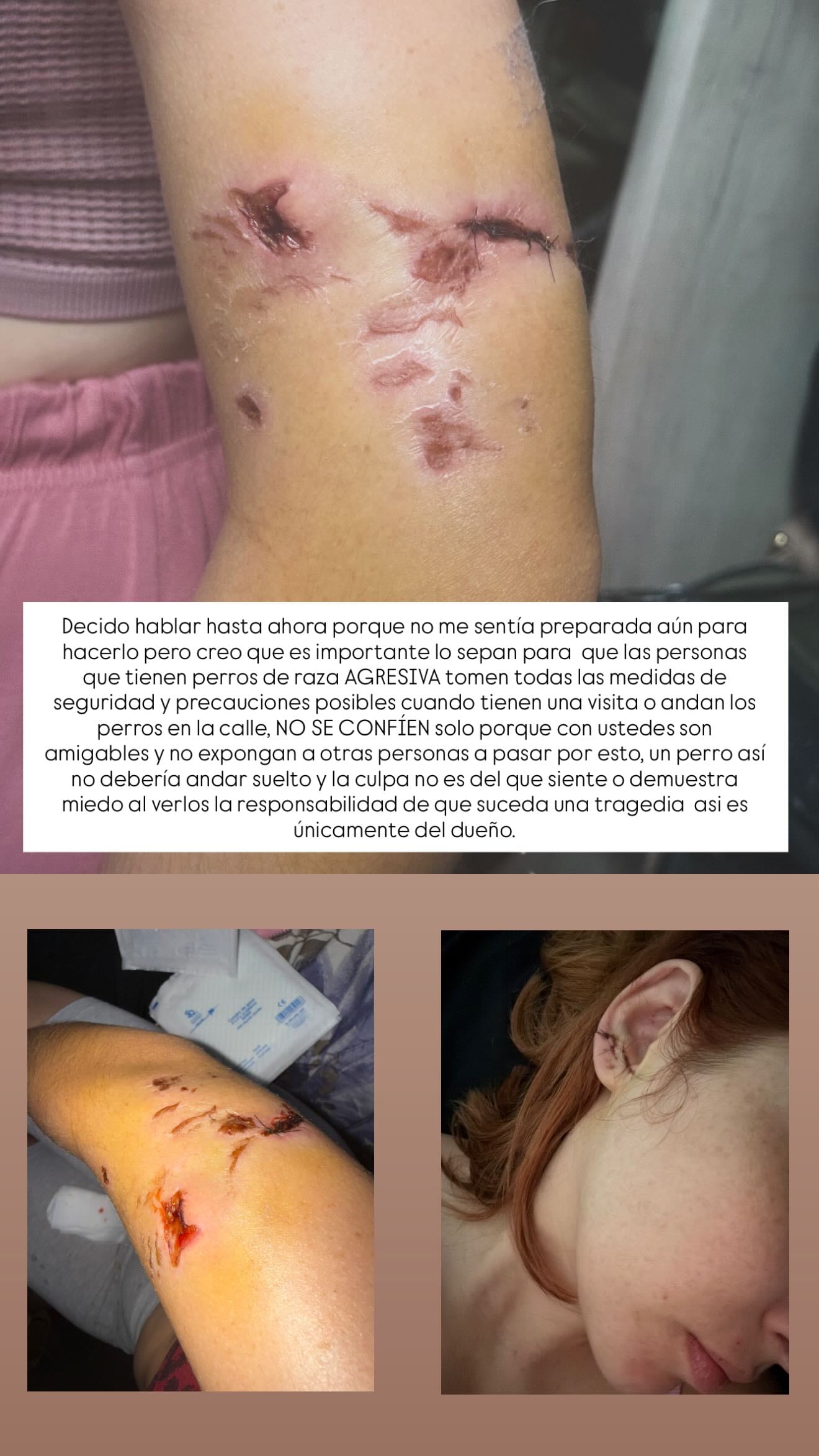 Andreína Méndez, bailarina costarricense.