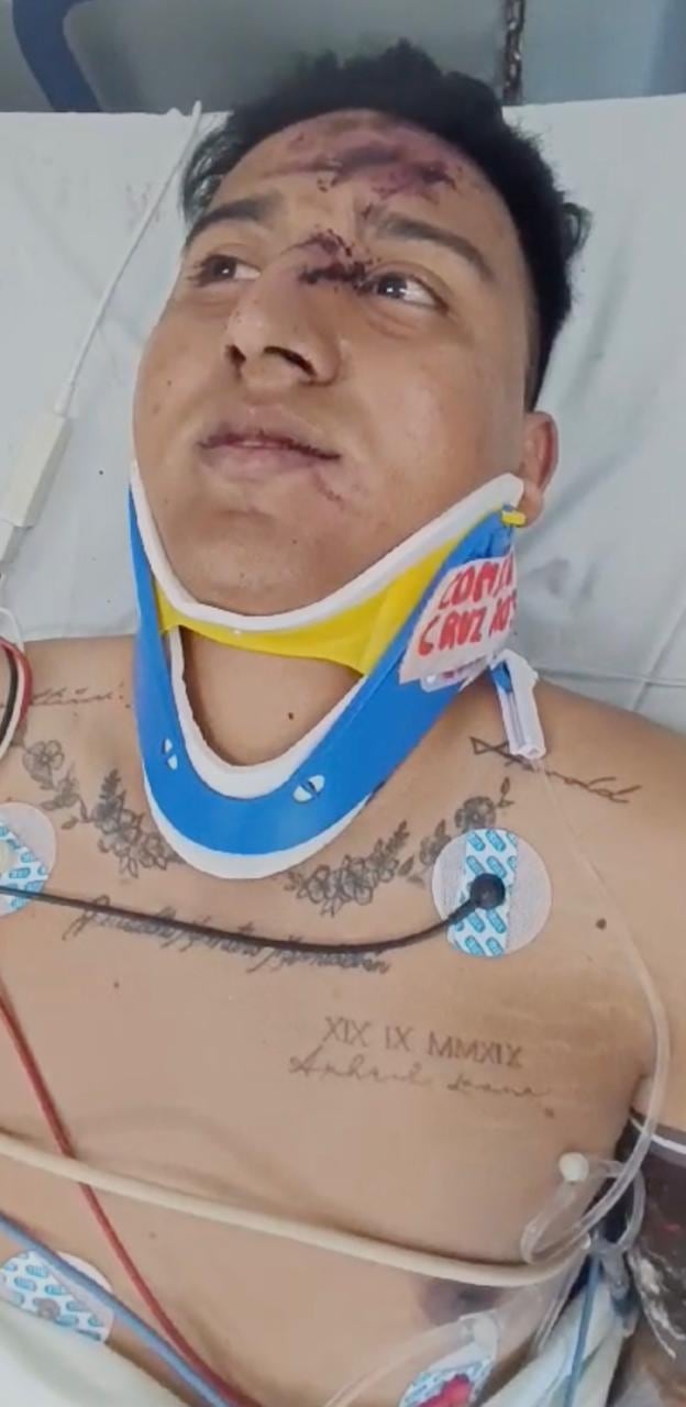 Yarold Cajina es vecino de Pavas y en el 2023 sufrió un accidente en moto que le impidió ir al Desfile de las Rosas 2024 cuando tenía todo listo con la banda municipal de Zarcero. El 2028 podrá cumplir ese sueño truncado.
