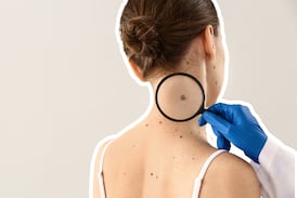 Moderna y Merck reportan resultados alentadores de su vacuna contra el cáncer de piel