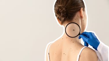 Moderna y Merck reportan resultados alentadores de su vacuna contra el cáncer de piel