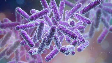 Un producto de uso diario apareció contaminado con una bacteria que puede provocar la muerte