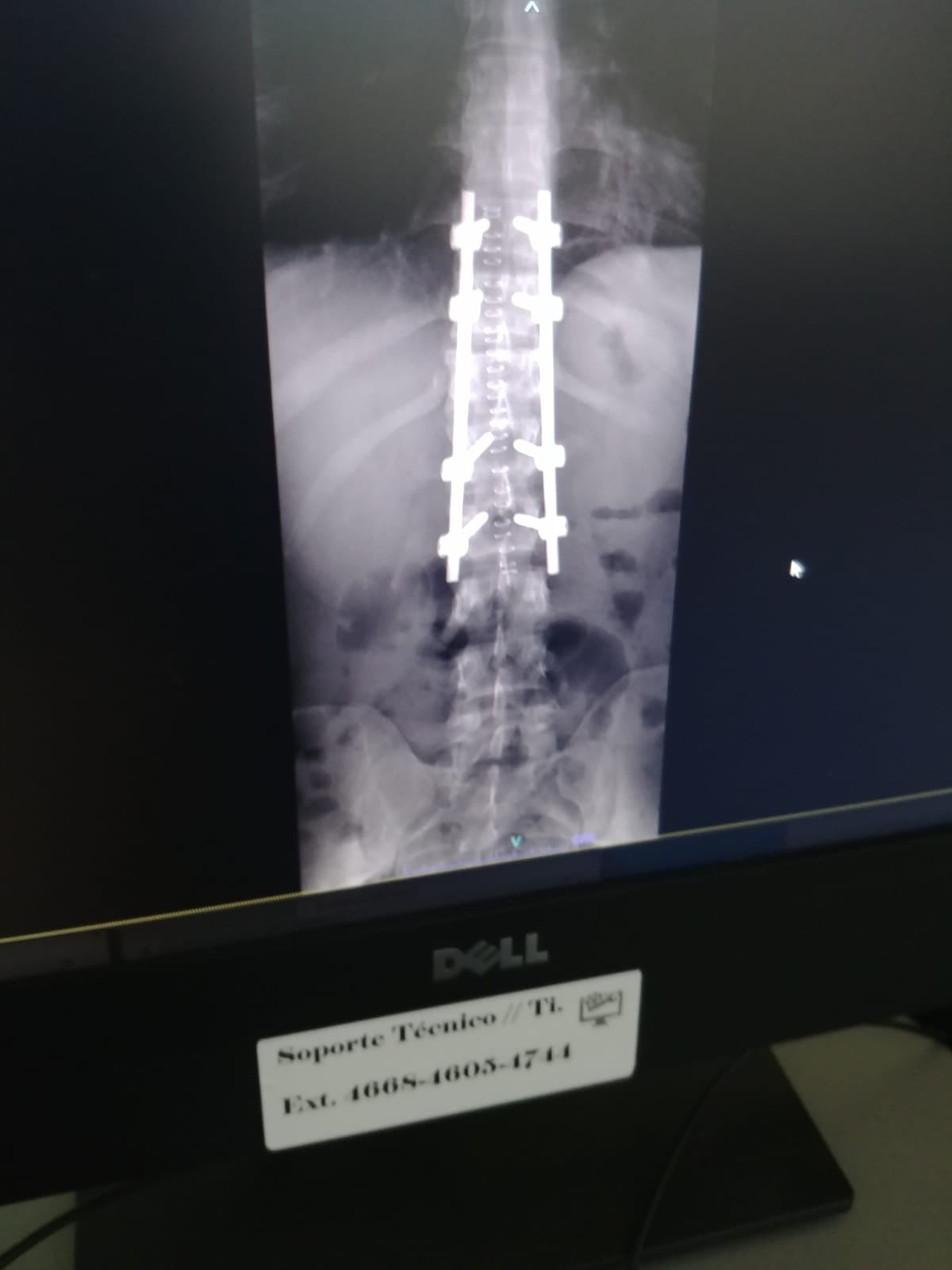 Jeison Quesada, oficial de Fuerza Pública que cayó de un puente con su moto. Foto cortesía Jeison Quesada.