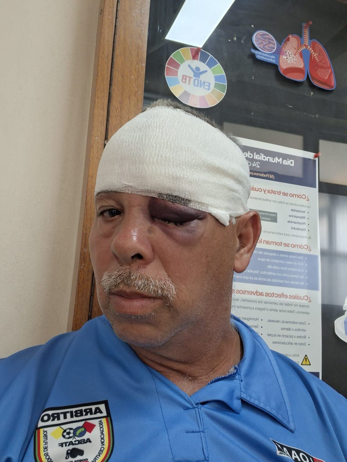 Un partido de fútbol de la categoría Sub-17 terminó convirtiéndose en una pesadilla para Marvin Ceciliano, al ser golpeado en la cara, desde el 2000 ejerce como árbitro y esta es la primera vez que enfrenta un momento grave por esta pasión. Foto: Marvin Ceciliano para La Teja