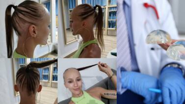 Mujer se hizo una cirugía para aumentar sus senos y tuvo consecuencias inesperadas