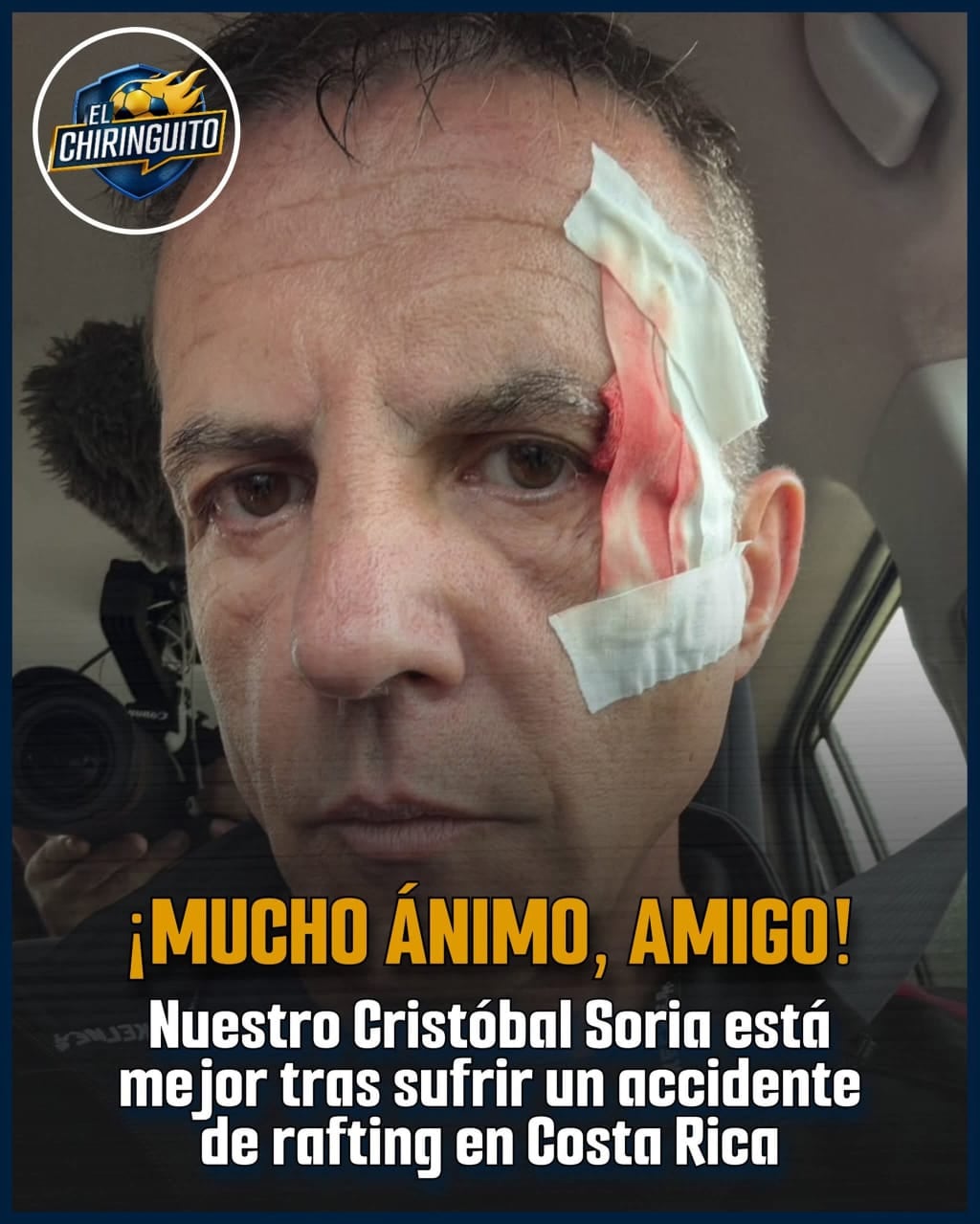 La figura de El Chiringuito presentó una cortadura en la ceja derecha tras el percance.