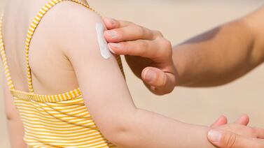 Semana Santa: Siga estos consejos y cuide su piel del sol