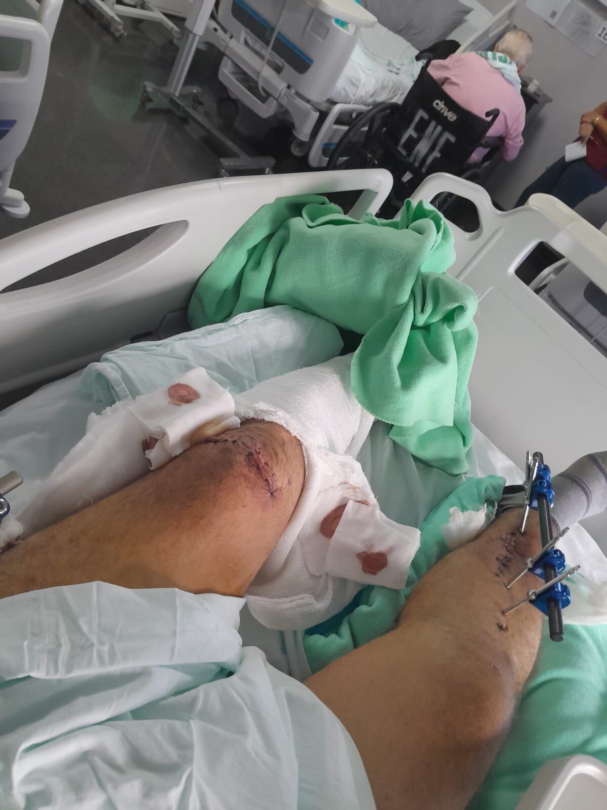 accidente en Los Chiles, choque cabezal carro