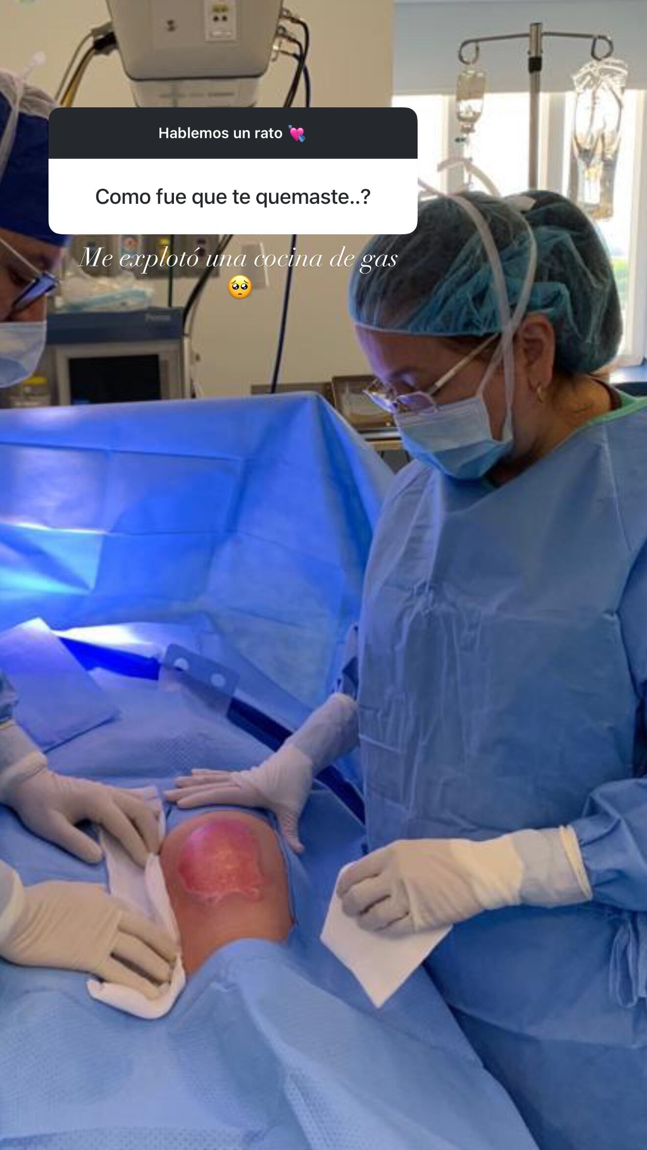 La cantante Fátima Pinto mostró en las últimas horas cómo quedó su pierna izquierda tras la seria quemadura que sufrió hace seis años por la explosión de una cocina de gas.