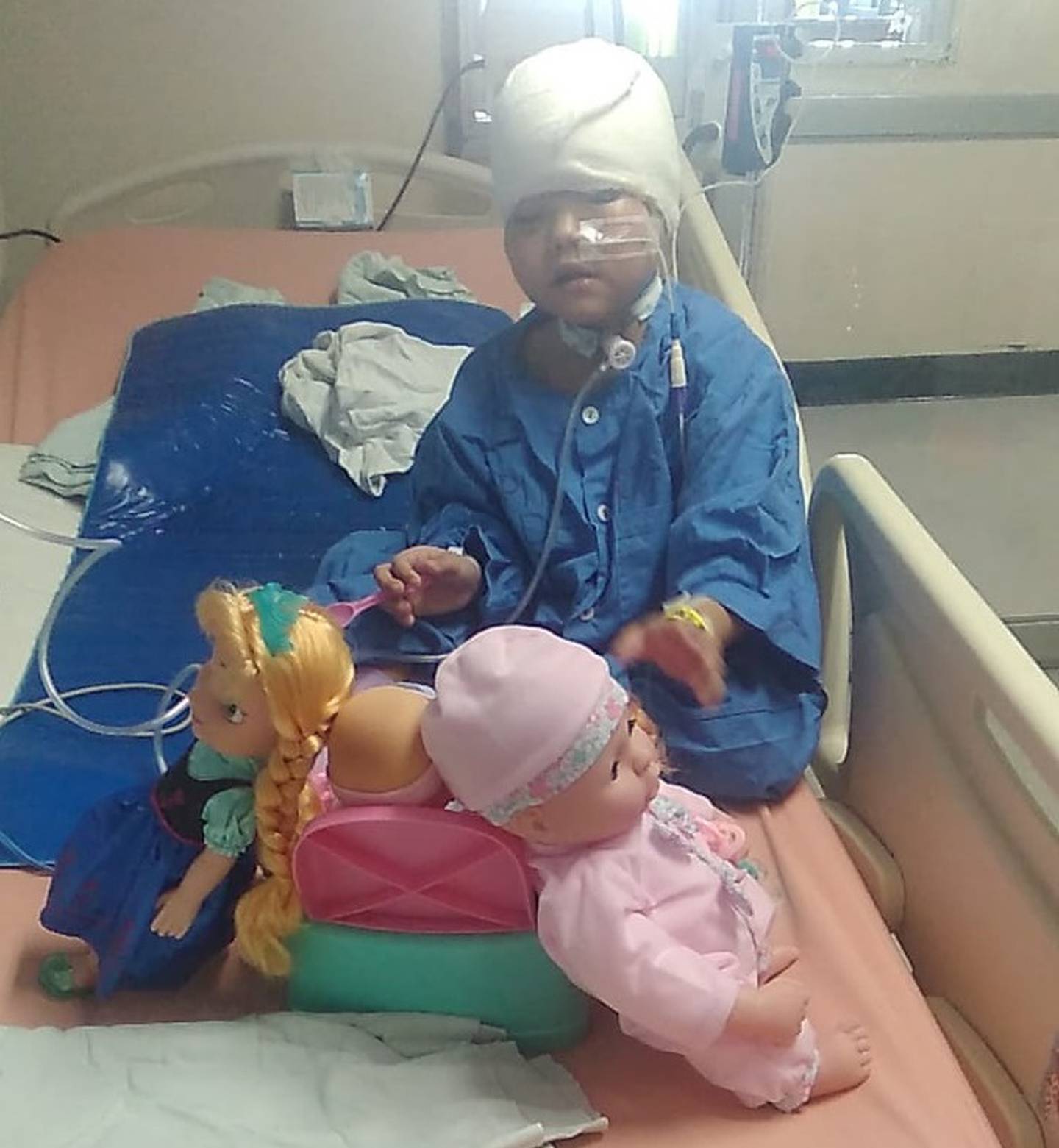 Chiquita de 5 años que sufrió accidente con picadora de zacate se recupera en el Hospital Nacional de Niños. Foto cortesía Wilfredo Hernández.