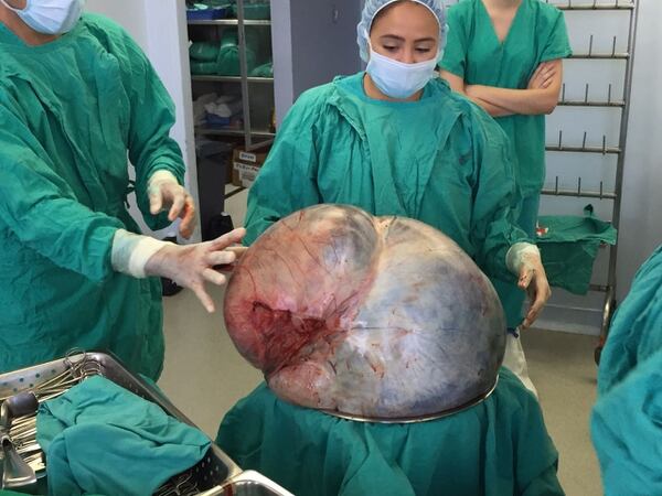Se necesitó un equipo de seis especialistas para llevar a cabo la operación. Foto: Cortesía Hospital México.